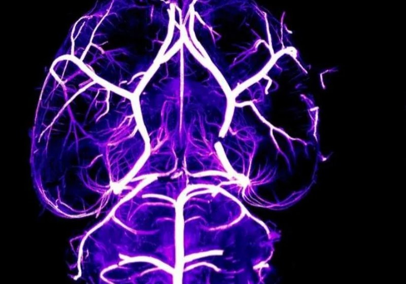 脑血管成像风格示意，血管成像 · 5×物镜 · 三维重构示意